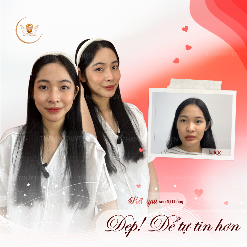 Độn thái dương