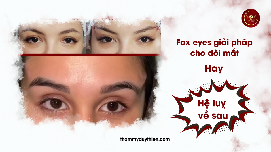 Foxeye giải pháp cho đôi mắt hay hệ luỵ về sau.