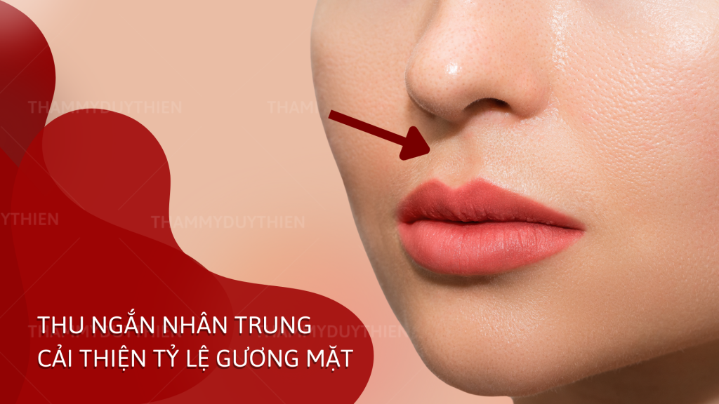 THU NGẮN NHÂN TRUNG CẢI THIỆN TỶ LỆ GƯƠNG MẶT