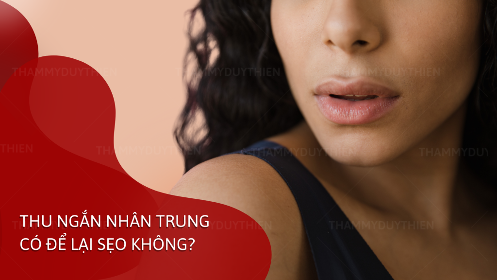 THU NGẮN NHÂN TRUNG CÓ ĐỂ LẠI SẸO KHÔNG?