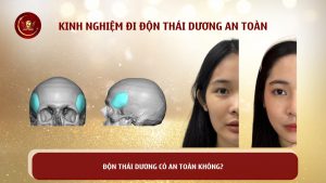 don thai duong co an toan khong