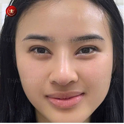 cắt-mi-mat-dep-tu-nhien