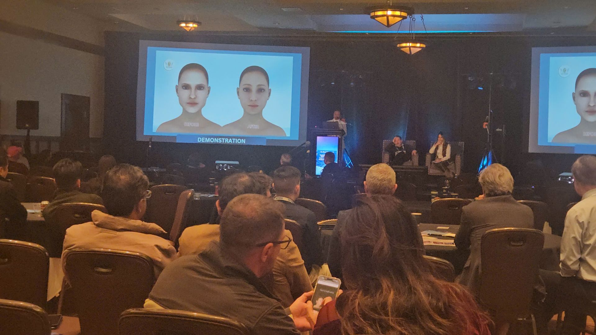 Bac-si-duy-thien-bao-cao-tham-my-tại-My-abam