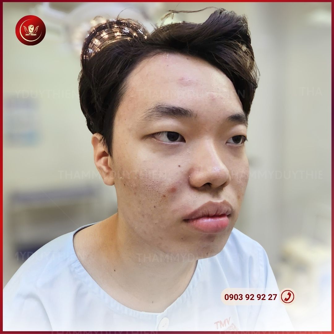 thay đổi diện mạo