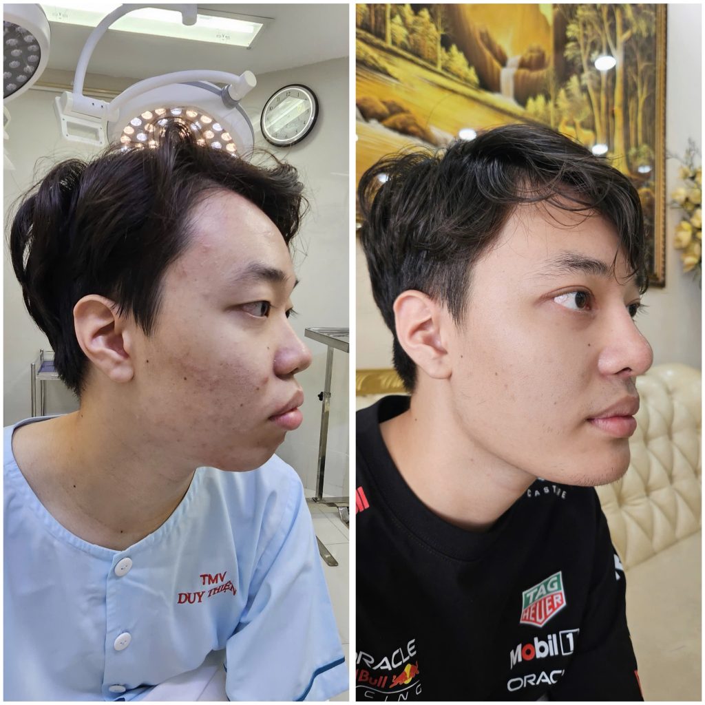 thay đổi diện mạo