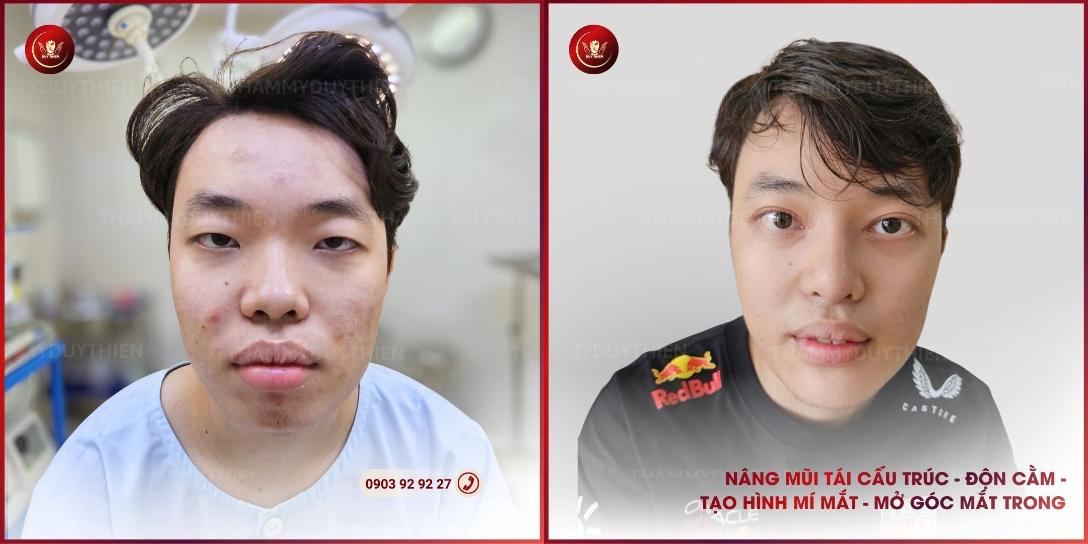 Thay đổi diện mạo