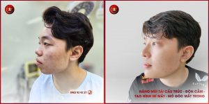 Thay đổi diện mạo