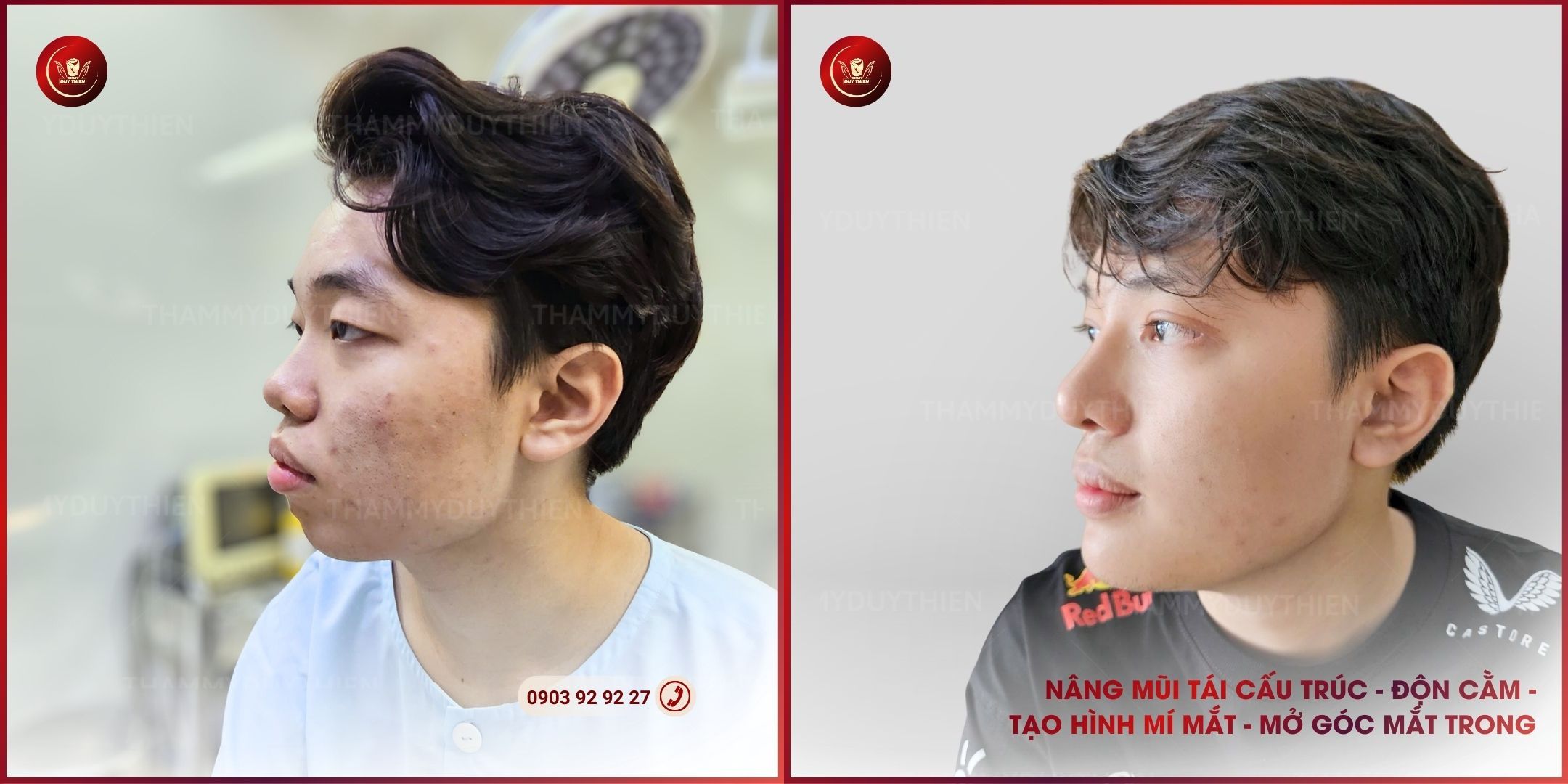 Thay đổi diện mạo