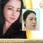 nang-mui-tai-cau-truc