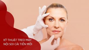 Kỹ thuật treo mày nội soi cho tuổi trung niên